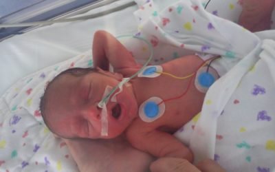 Cuidados Especiales en Bebés Prematuros