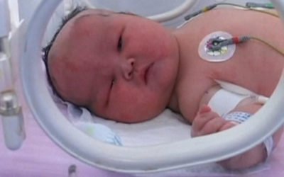 Trastorno de la glándula tiroides en niños