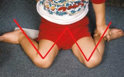 Porque es malo que los niños se sienten en «w»